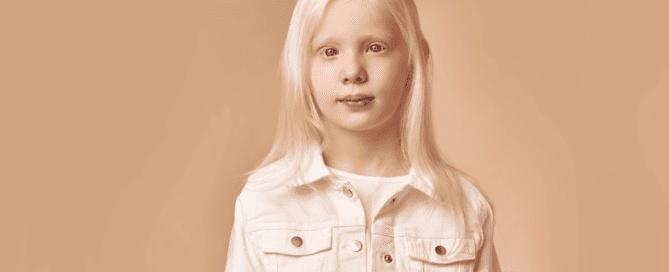 albinismus und augen 1